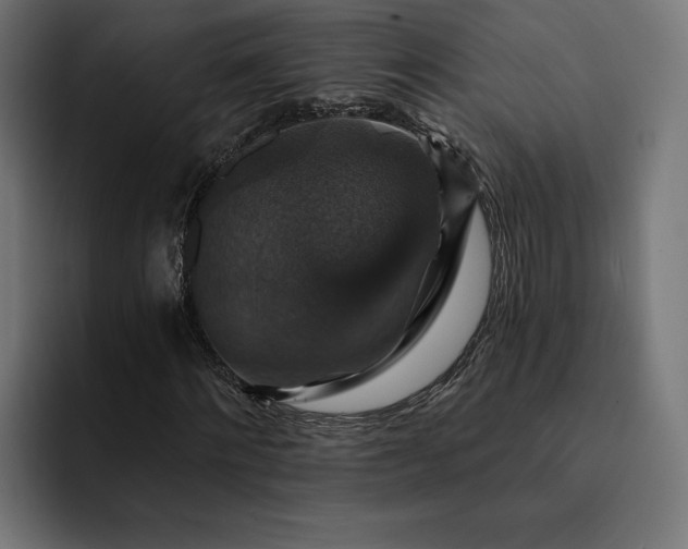 X0000093130868200710101057