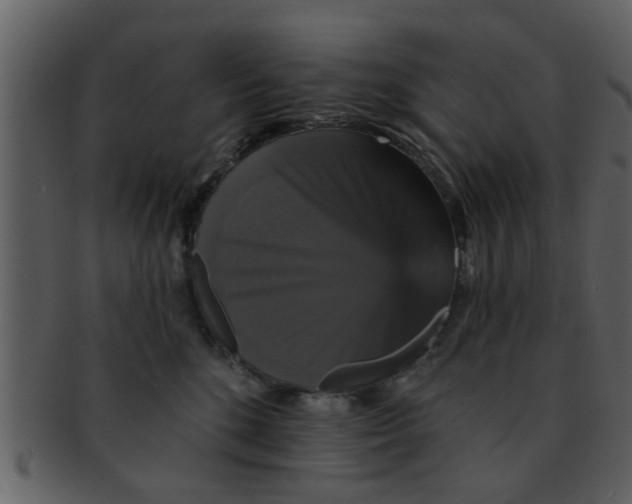 X0000093130520200710171310