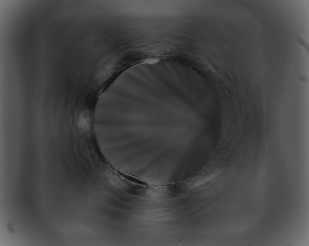 X0000093130720200710171307