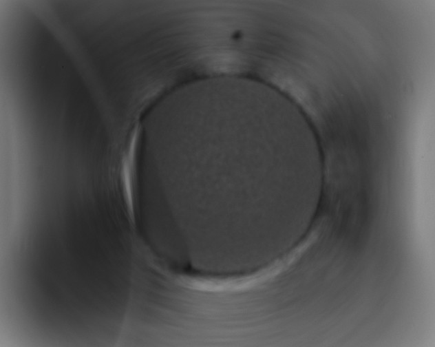 X0000093140017200710031418