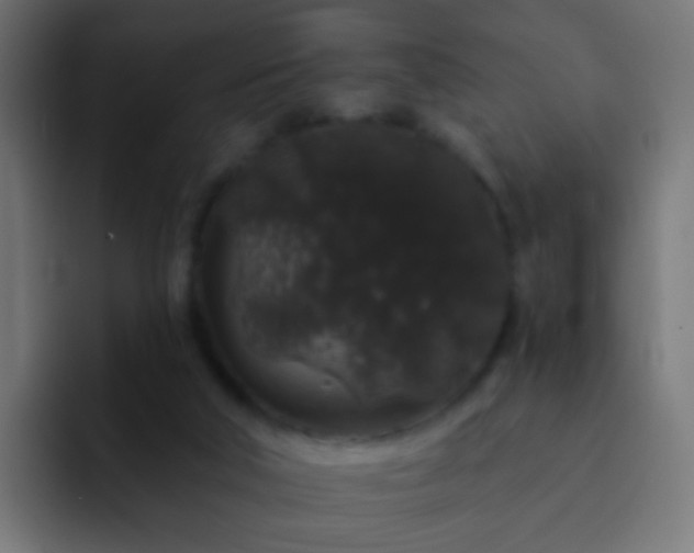 X0000093140018200710031418