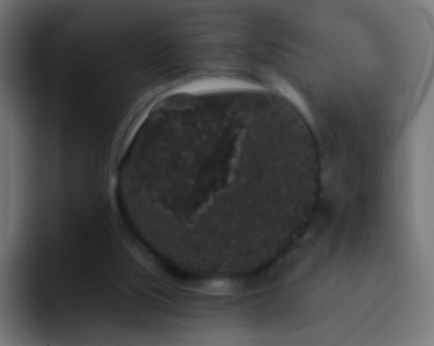 X0000093140059200710031417