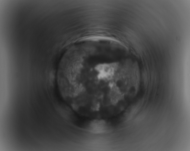 X0000093140271200710031415