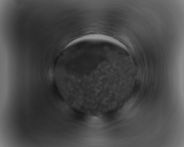 X0000093140285200710031415