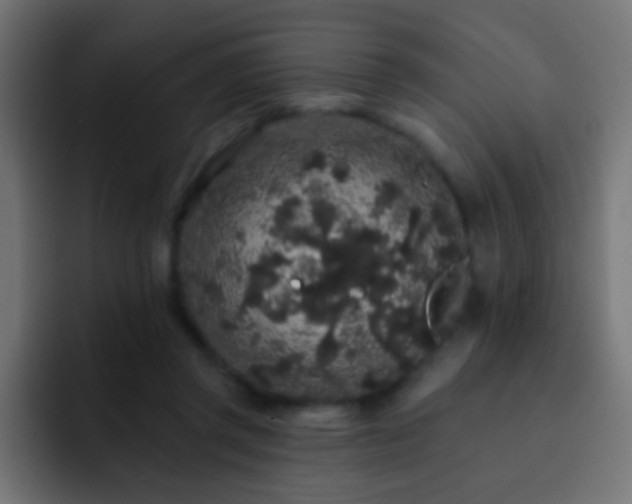 X0000093140357200710031414