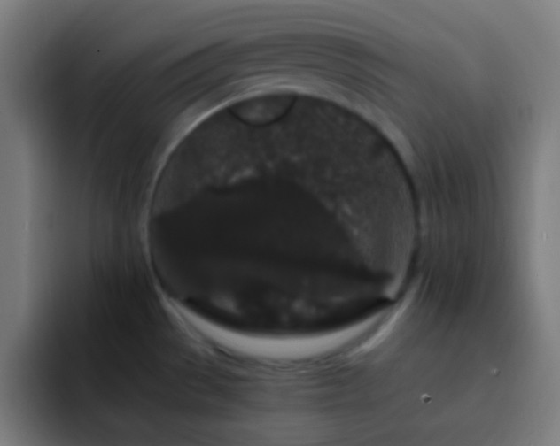X0000093141529200710031401