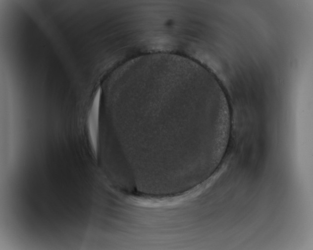 X0000093140017200710101125