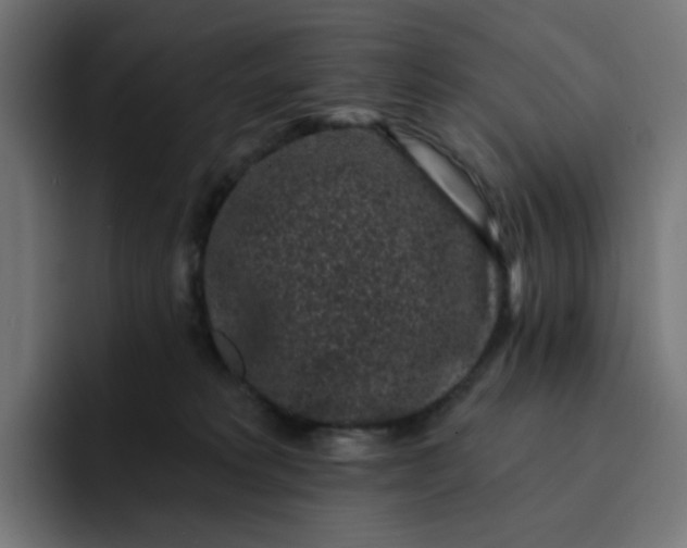 X0000093140229200710101123