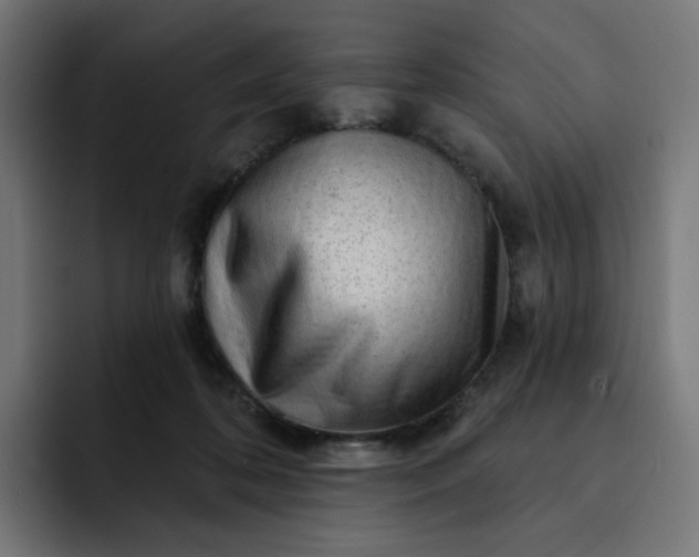 X0000093140316200710101122