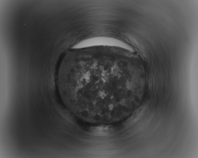 X0000093140366200710101121