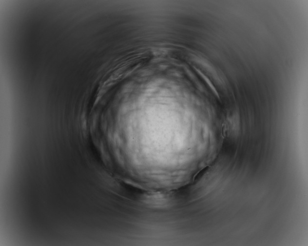 X0000093140381200710101122