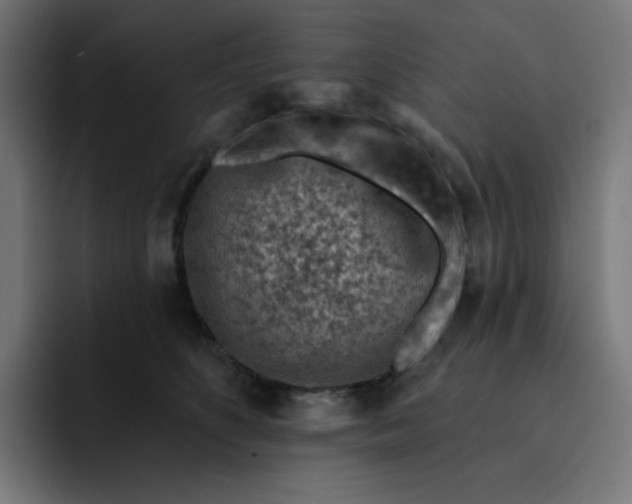 X0000093140516200710101120