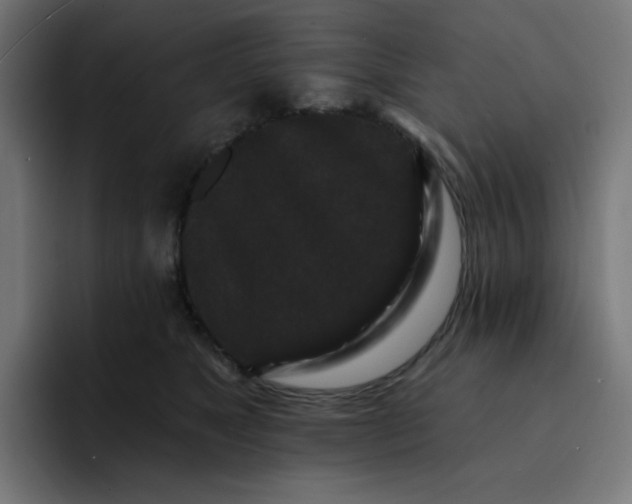 X0000093140517200710101120