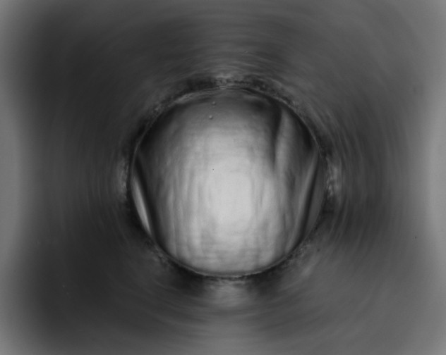 X0000093140664200710101118