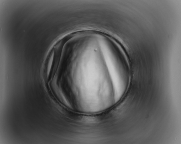 X0000093141509200710101108