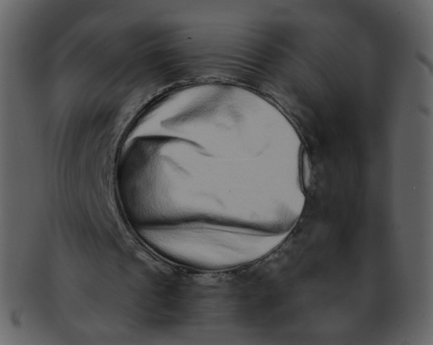 X0000093140241200710171335