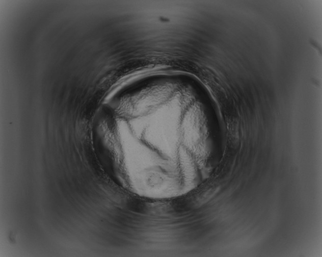 X0000093140511200710171332