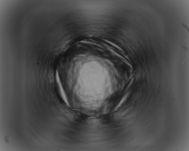 X0000093140620200710171330