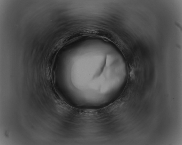 X0000093140819200710171327