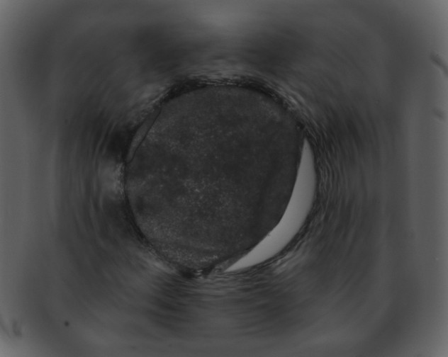 X0000093141156200710171323