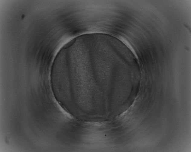 X0000093141197200710171322