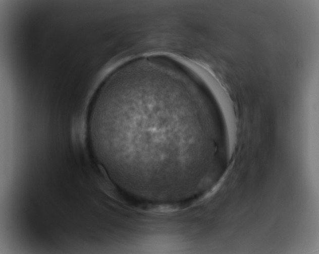 X0000093150056200710031435