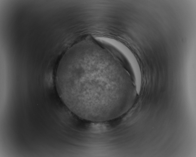 X0000093150520200710101138