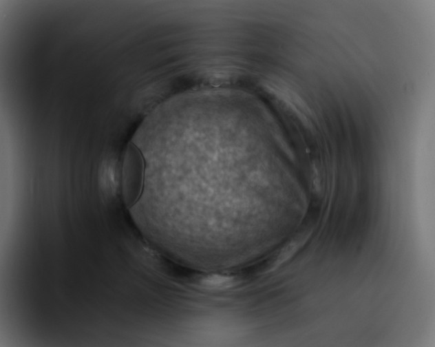 X0000093150718200710101135