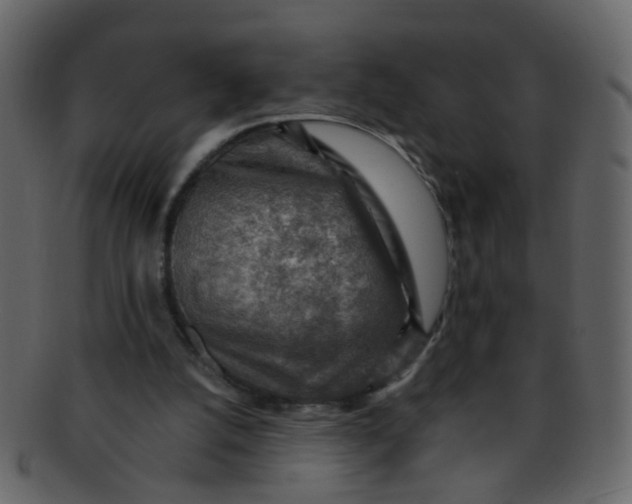 X0000093150056200710171359