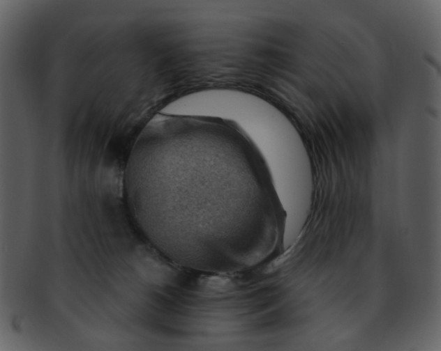 X0000093150180200710171358