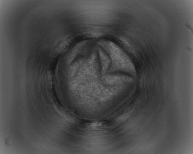 X0000093150366200710171355