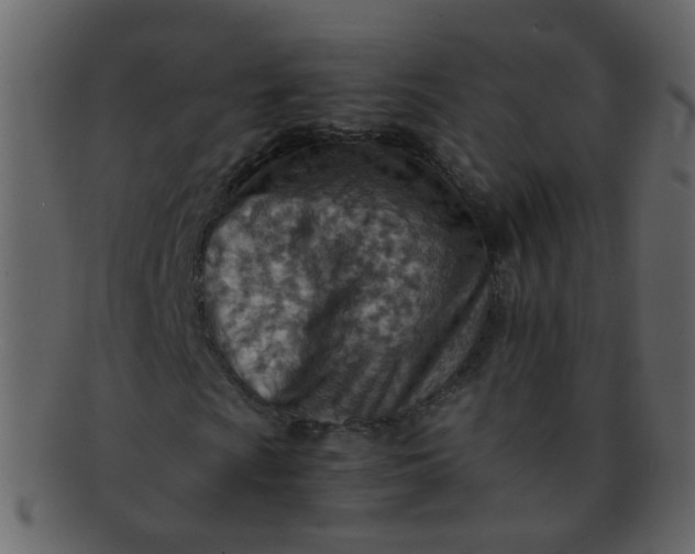 X0000093151009200710171346