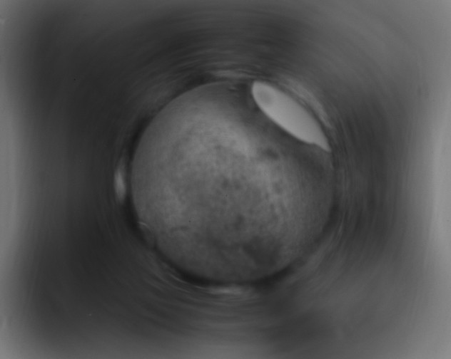 X0000093160069200710031453