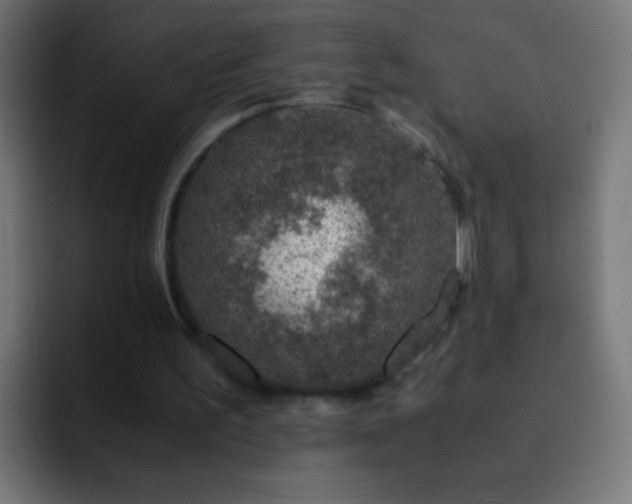 X0000093160195200710031452