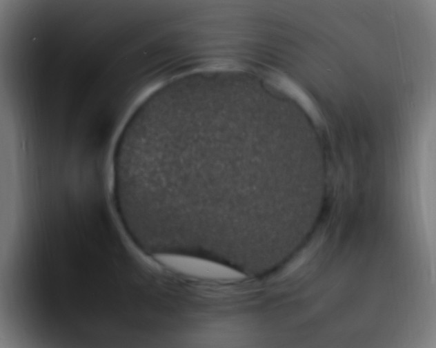 X0000093161095200710031441