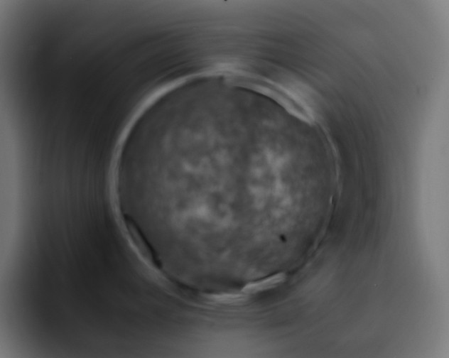 X0000093161392200710031438