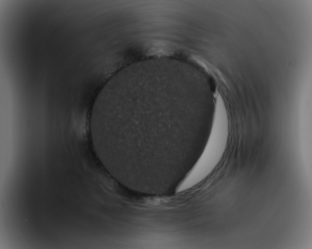 X0000093160517200710101156