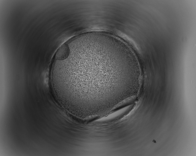 X0000093161170200710101148
