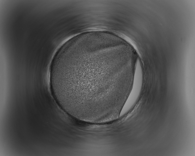 X0000093161179200710101148