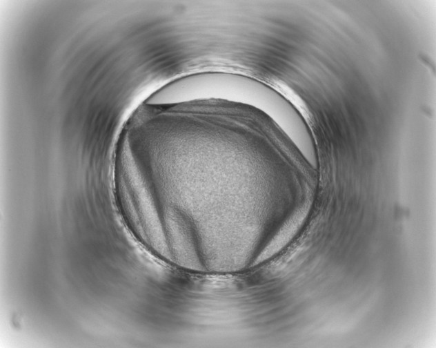 X0000093161144200710241015