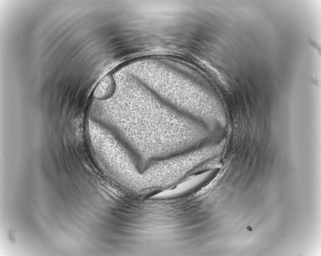 X0000093161170200710241014
