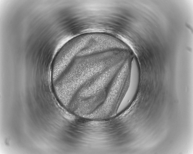 X0000093161179200710241014