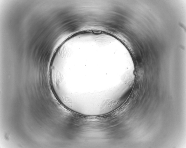 X0000093161199200710241014