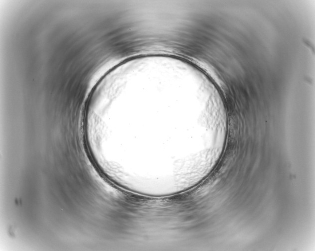 X0000093161387200710241011