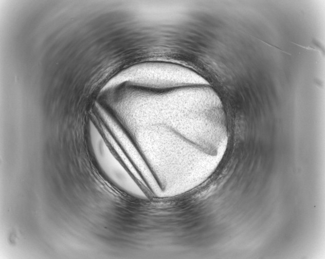 X0000093161401200710241011
