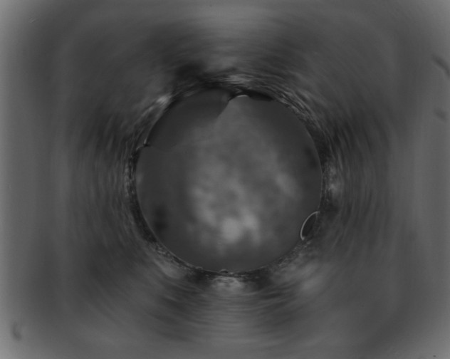 X0000093170519200709261531