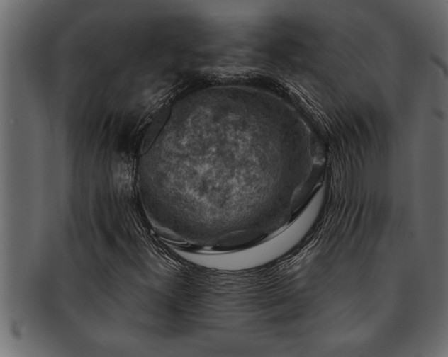 X0000093171300200709261520