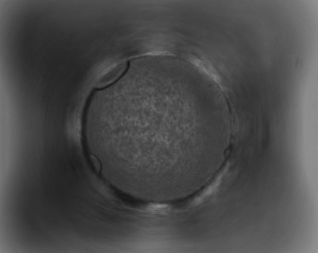 X0000093170055200710031511