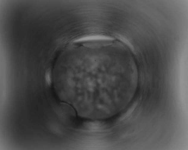 X0000093170069200710031511