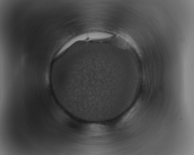 X0000093170393200710031507